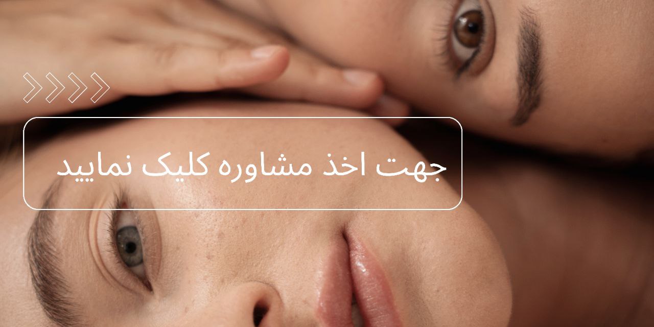 اخذ نوبت